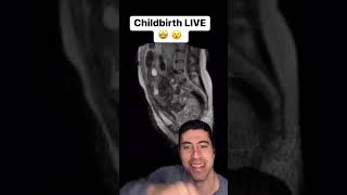 #childbirth #live inside #MRI