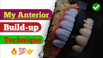 My Anterior Build-up Technique|| Ceramic Porcelain| Anatomy| Dental Videos|  How to make teeth| Dant