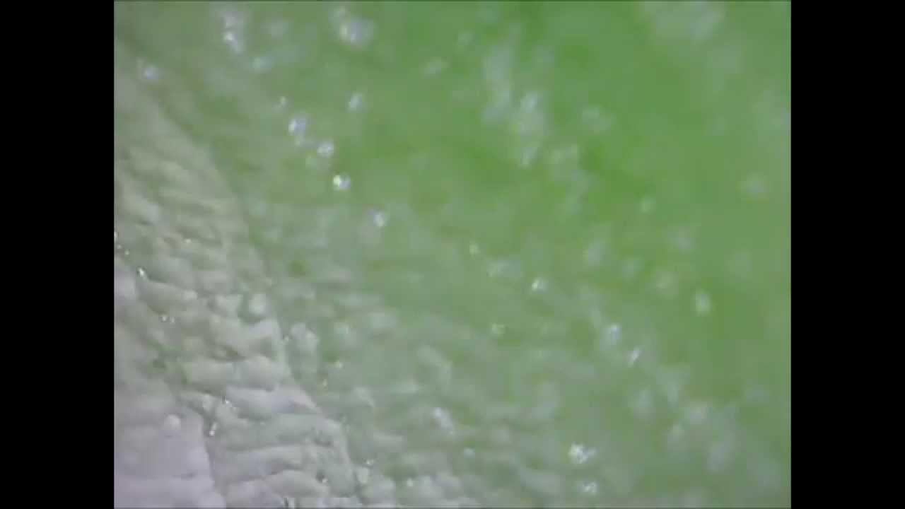 Lettuce Under a Microscope YouTube