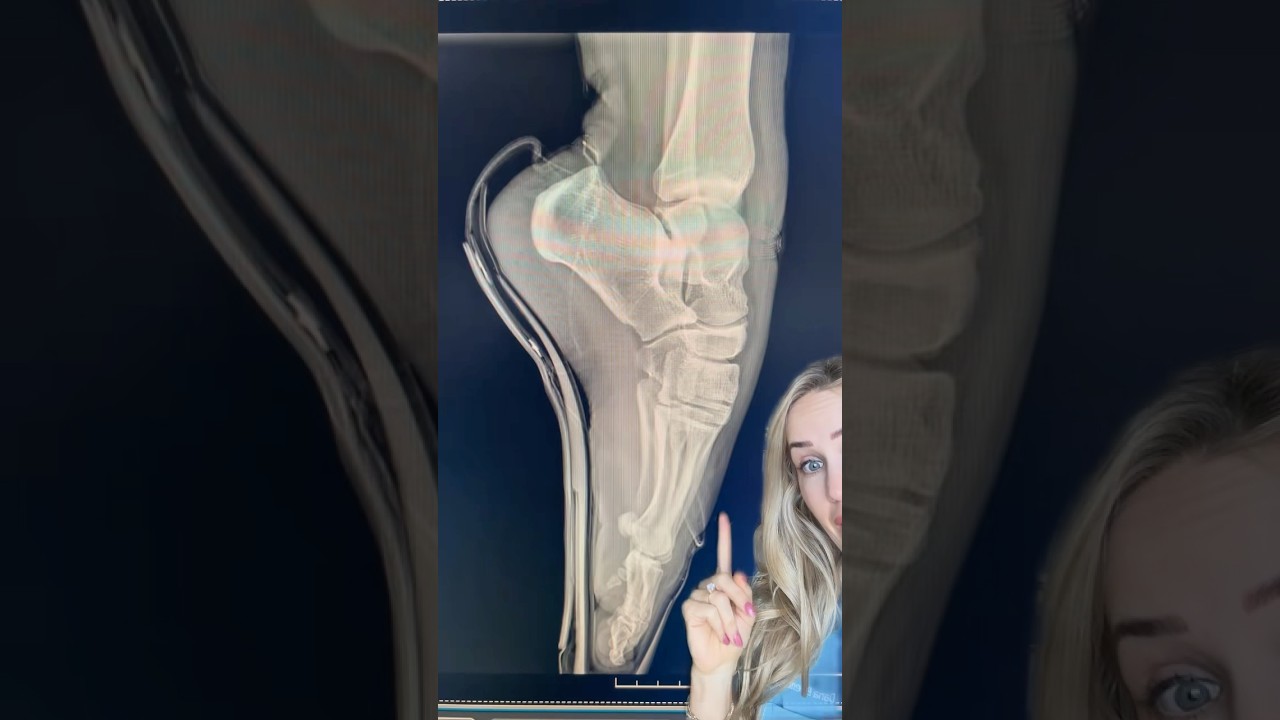 Why ballet is harder than it looks 😳