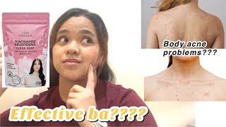 BODY ACNE(BACKNE) SOLUTION! LUXE ORGANIX CLOUD SOAP REVIEW | PHILIPPINES