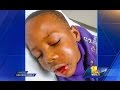Teacher Breaks Jaw Of ‘Disruptive’ 7-Year-Old Student Teacher Breaks Jaw Of ‘Disruptive’ 7-Year-Old Student