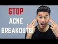 10 Things You Didn’t Know Cause Acne