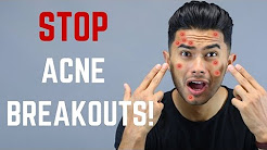 10 Things You Didn’t Know Cause Acne