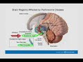 12. OhioHealth Parkinson’s Lecture – Medications