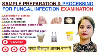 Sample preparation | Processing for fungal infection examination | LCB | KOH | SDA | CMA | BHI | MLT