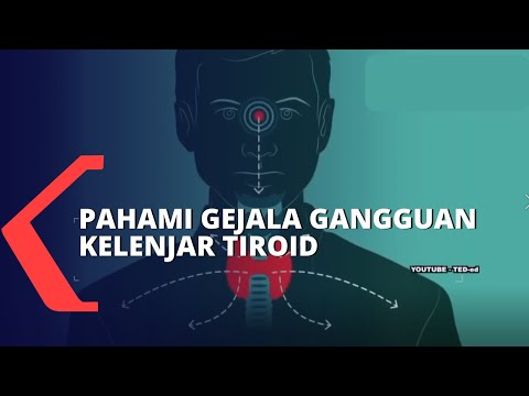 Video: Gondok Beracun Menyebar - Gejala, Derajat, Pengobatan