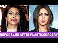 Plastic Surgery से पहले और बाद की 10 बॉलीवुड अभिनेत्रियाँ | 10 Actresses Before and After Surgery