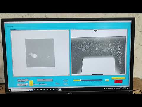 Karma Digital Radiography Reporting Including Size Calibration