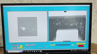 Karma Digital Radiography Reporting Including Size Calibration