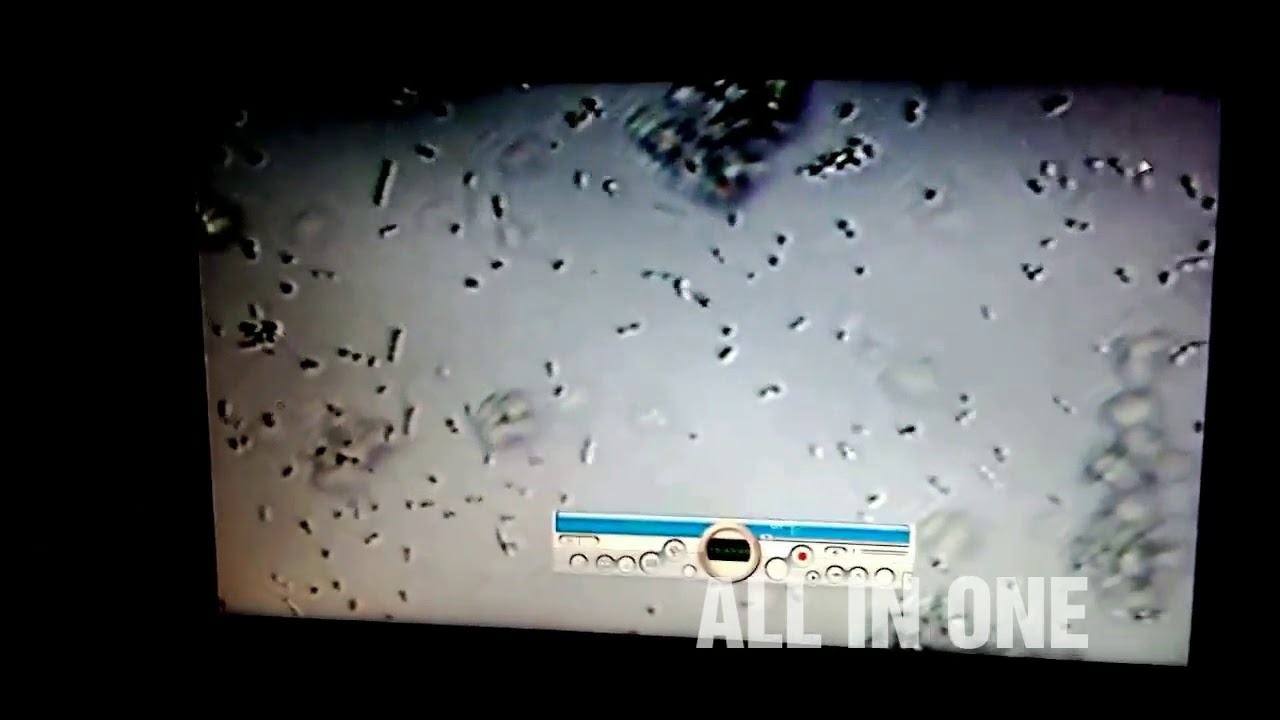 Bacteria inside the CURD YouTube