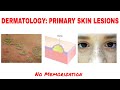 Dermatologyprimary skin lesions macule patch papule plaque vesicle  usmle mcc clinical medicine