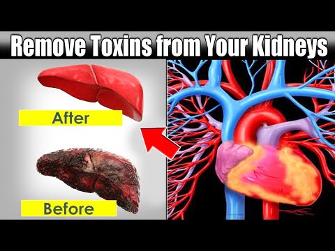 Detox &amp; Cleanse Your Liver: Remove Toxins from Your Kidneys, Liver and Bladder Gently YetEffectively