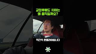 치아가 약간씩 움직여야 하는 이유 #shorts