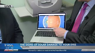 Symptoms of eye damage after solar eclipse 6am