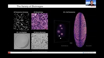 I2K 2020 tutorial: Object segmentation and image restoration with StarDist and CSBDeep