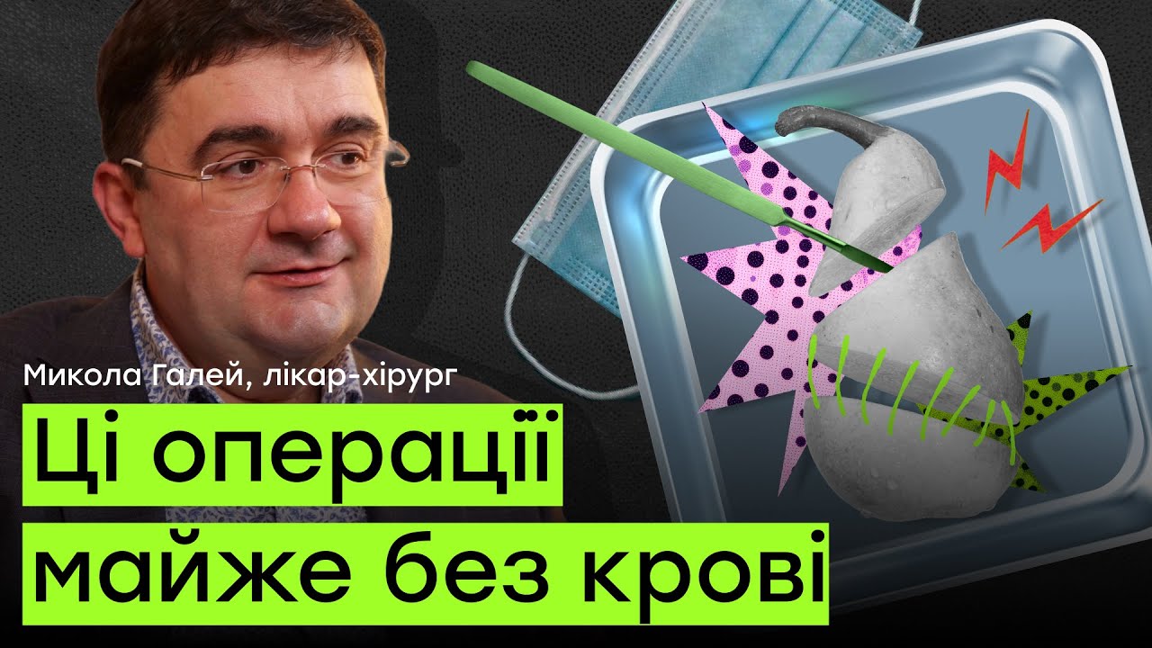 Зменшення шлунку, лапароскопія і міфи про хірургію | Лікарі, маю питання