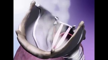 Learn@Visible Body - Function of the Larynx - Phonation