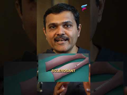 Varicose Vein EXPERT