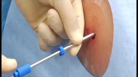 Muscle Biopsy