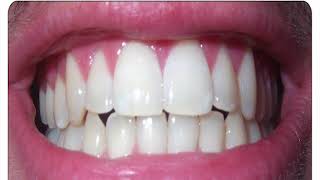 Forensic Significance of Odontological studies