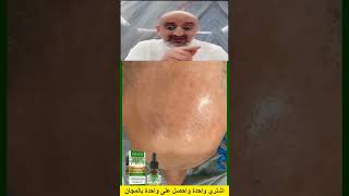 زيت اكليل الجبل للشعر 0708800222