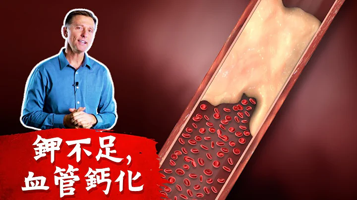 (血管1)血管鈣化,動脈硬化,血管增厚,高血壓-鉀不足,自然療法, 柏格醫生 Dr berg - 天天要聞