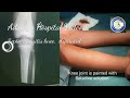 Paediatric knee injuries  septic arthritis knee aspiration  therapeutic knee aspiration  adamya h