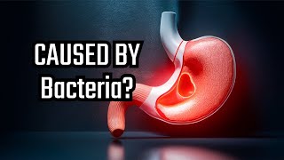 The Surprising Cause of Stomach Ulcers