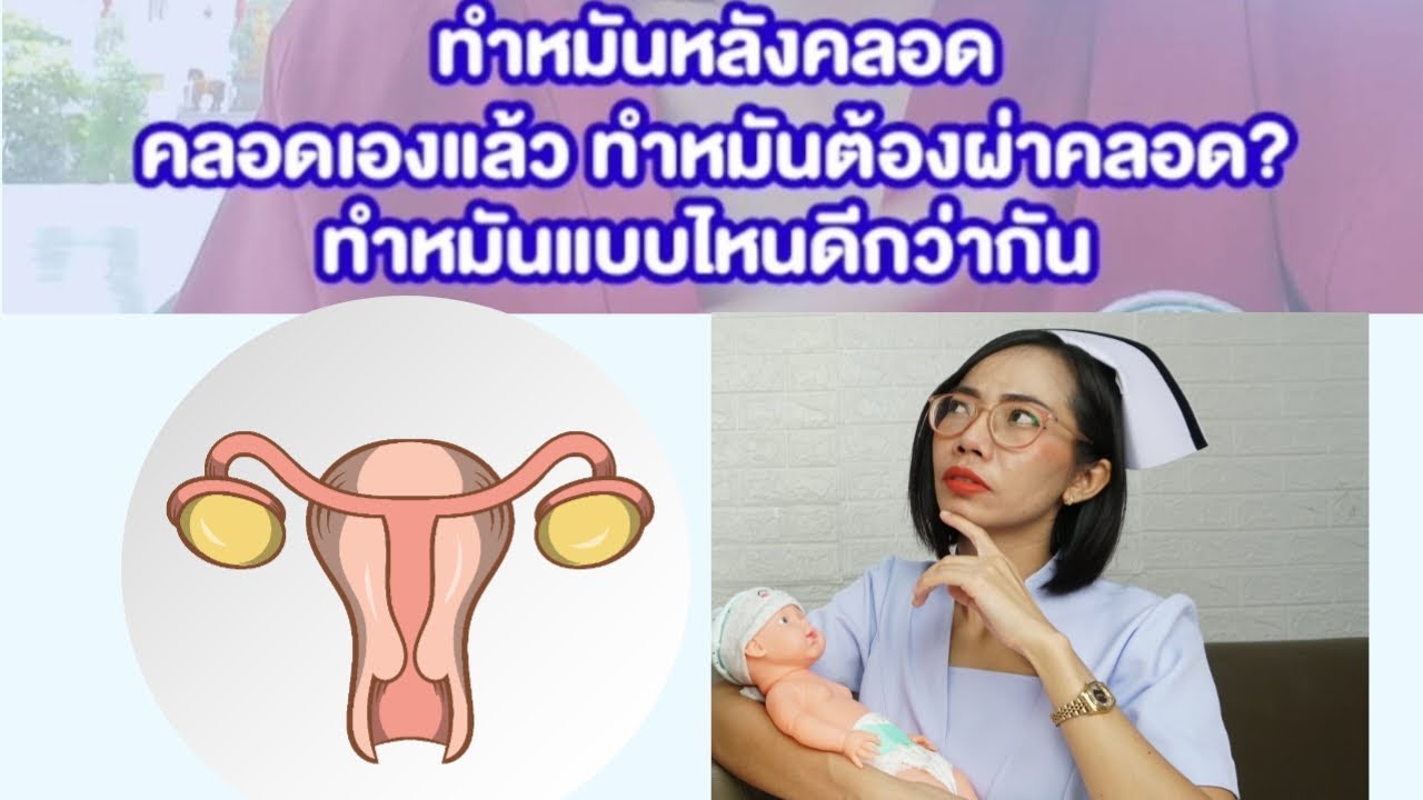 ทําหมันหลังคลอด คลอดลูกเองแล้วต้องการทำมันต้องผ่าไหม พักฟื้นนานไหม|แม่โบNurse Kids
