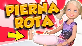 Rota gota pierna y