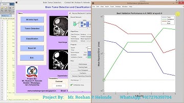 Matlab Code for Brain Tumor Detection Using Neural Network