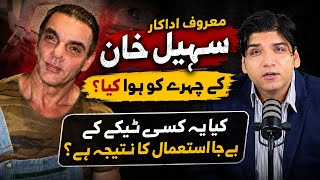 Mashhoor Actor Sohail Khan ke chehre ko hua kya? Aaeyn medically samajhte hain || Dr Affan Qaiser