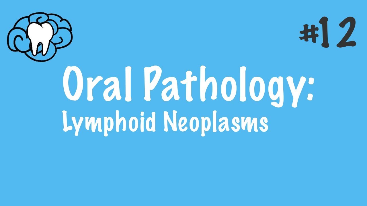 Oral Pathology | Lymphoid Neoplasms | INBDE, ADAT