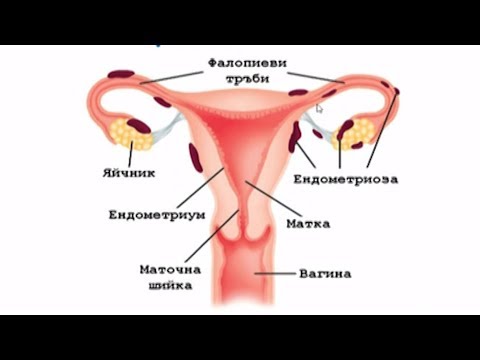 Видео: Бартолинит по време на бременност - причини, симптоми и лечение на бартолинит по време на бременност