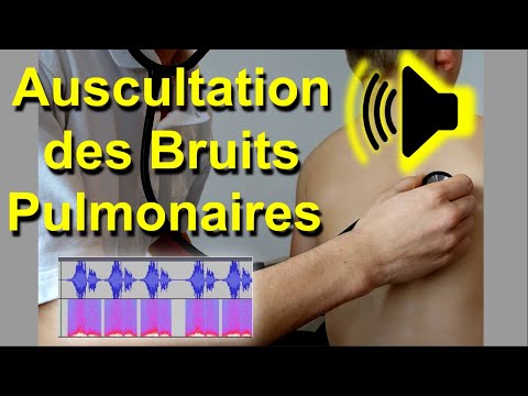 Bruits pulmonaires anormaux Auscultation Son Audio Poumon murmure vésiculaire frottement pleural