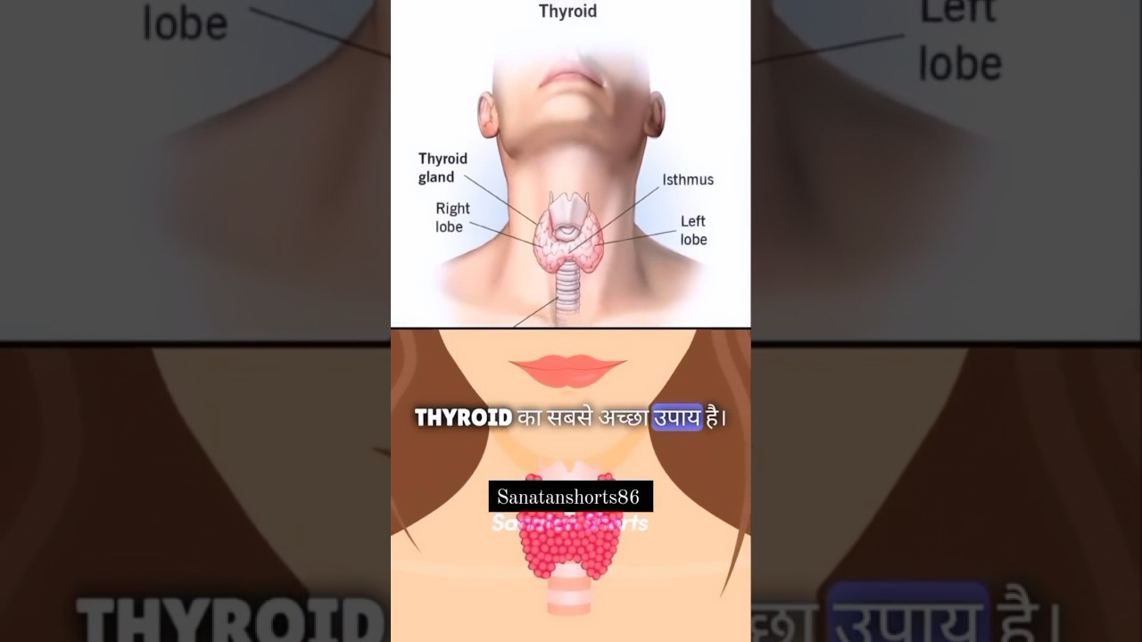 THYROID ka sabse Achha ilaaj dhaniya | Thyroid best treatment #￼thyroid #rajeevdixit