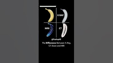 images #medicalscience #xray #ctscan #mri #difference #health #shorts #youtubeshorts #science #yt
