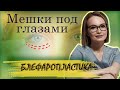 Как избавиться от мешков под глазами | Нижняя блефаропластика в пластической хирургии