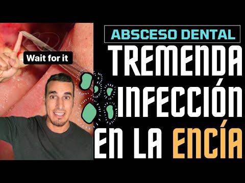 Video: ¿Qué tan rápido puede ocurrir un absceso dental en un perro?