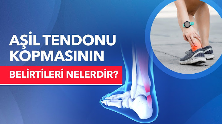Aşil Tendonu Nedir? Aşil Tendonu Kopması Belirtileri Nelerdir? - Profesör Doktor Hakan Özsoy