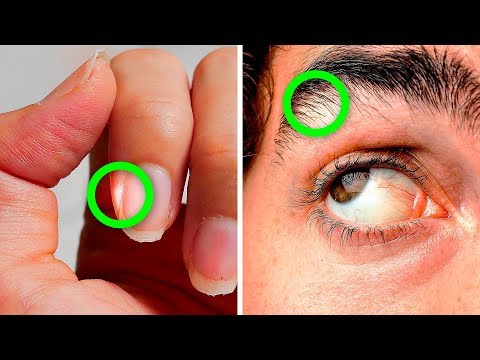 Video: Zucken Der Augenbrauen: Ursachen, Behandlung Und Mehr