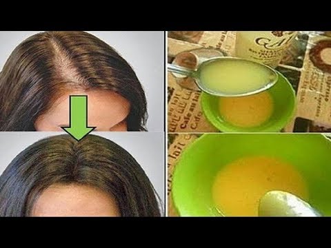 Video: Eigelb Für Das Haar: Vorteile, Verwendung Für Das Haarwachstum Und Mehr