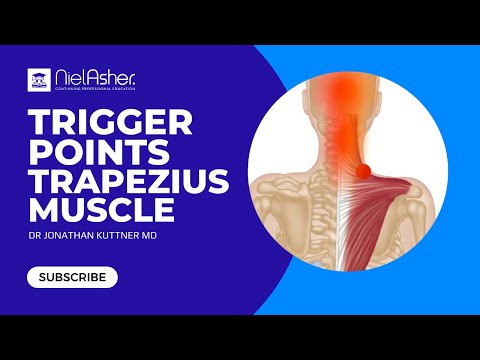 Trapezius - How To Find Trigger Points