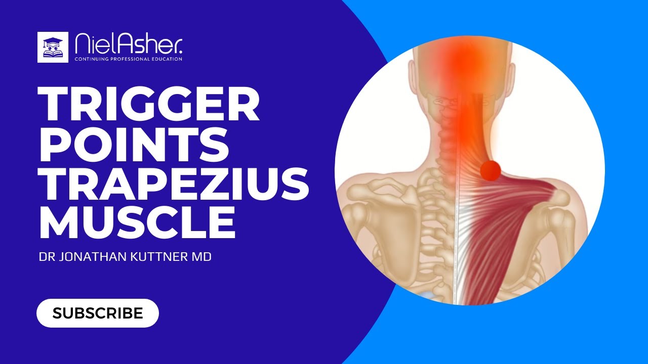 Trapezius muscle pain & trigger points