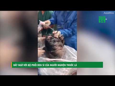 Bất ngờ với bộ phổi đen sì của người nghiện thuốc lá | VTC14