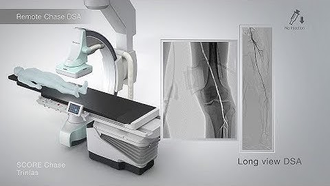 SCOREChase KS 100 DSA YT