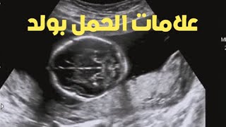 حامل بولد لو عندك العلامه دي