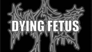 Video voorbeeld van "Raping the system-Dying Fetus"