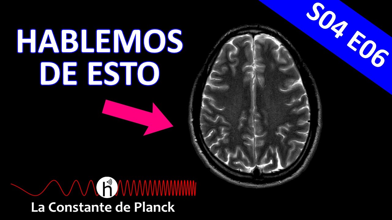 ¿Cómo funciona la RESONANCIA MAGNÉTICA?